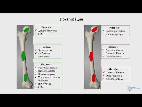 Видео: Диагностика опухолей костей  современный взгляд морфолога. Рогожин Д.В.