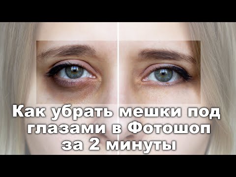 Видео: Как убрать мешки под глазами в Фотошопе [Избавляемся от мешков под глазами в Photoshop за 2 минуты]