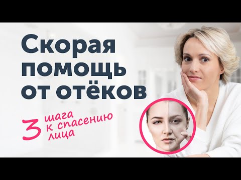 Видео: Откуда ОТЁКИ? 3 шага к спасению лица.