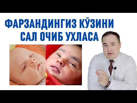 Видео: БОЛАНГИЗ УХЛАГАНДА КЎЗЛАРИ САЛ ОЧИҚ ТУРИШИ САБАБЛАРИ, НИМА ҚИЛИШ КЕРАК ВА АСОРАТИ ҲАҚИДА / ИСЧАНОВ