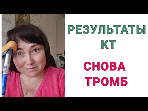 Видео: РАК ЗАПЕР МЕНЯ ДОМА И ПОСТАВИЛ НА КОСТЫЛИ