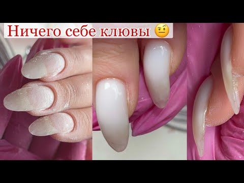 Видео: Ого жесть 😬 Ногти закрученные в низ 👇 Исправление