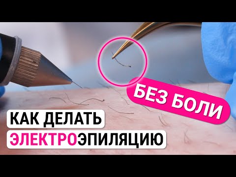 Видео: Урок №39. Техника проведения электроэпиляции: как делать электроэпиляцию без боли