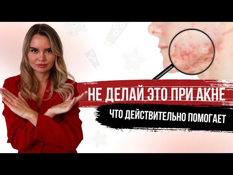 Видео: Почему тебя осыпает: честные наблюдения косметолога о коже?
