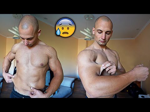 Видео: ЖИВОТ БЕЗ ЗОБ Еп.2 - Кожата увисва..