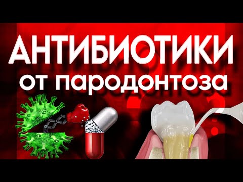 Видео: Антибиотики от пародонтоза. А оно надо?