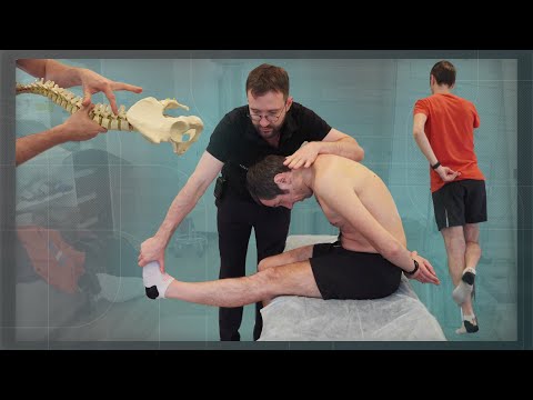 Видео: После бега появляется боль в ноге. Трудно приседать. | НАПРИЁМЕ