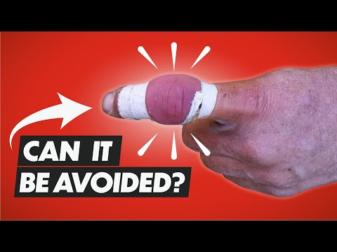 Видео: Как избежать травм при скалолазании — 2 ключевых шага