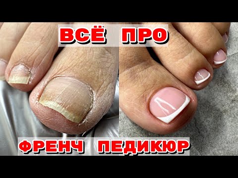 Видео: ПЕДИКЮР 🦶 Ногти сухарики 🦶 Френч на ногах 😍 Идеальные камуфляжи