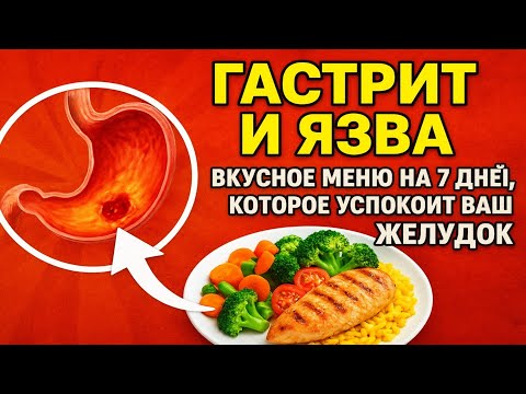 Видео: ГАСТРИТ и ЯЗВА: Вкусное меню на 7 дней, которое успокоит ваш желудок 🍲