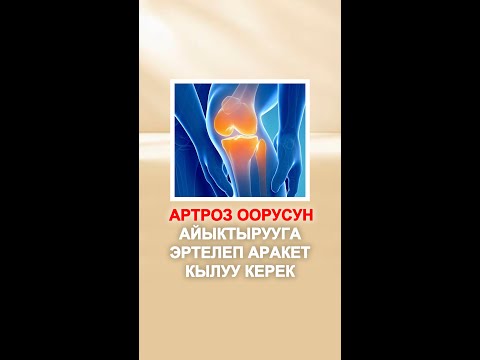 Видео: АРТРОЗ ООРУСУН АЙЫКТЫРУУГА ЭРТЕЛЕП АРАКЕТ КЫЛУУ КЕРЕК | Бекзат Болотбек