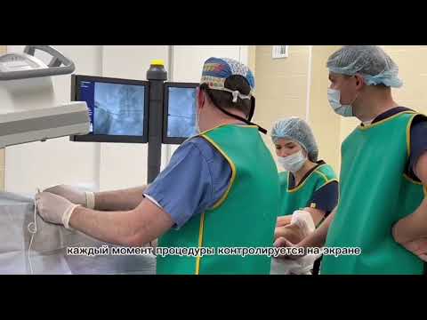 Видео: Импульсная радиочастотная абляция спинномозгового корешка