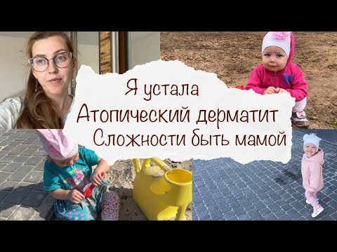 Видео: СЛОЖНОСТИ БЫТЬ МАМОЙ ДВОИХ 😟 НЕУЖЕЛИ АТОПИЧЕСКИЙ ДЕРМАТИТ 😭 УСТАЛА В КРАЙ 😩 ВЛОГ