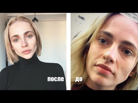 Видео: КАК ПЕРЕСТАТЬ ОТЕКАТЬ | скулы | питание