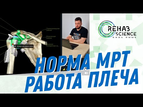 Видео: МРТ Плечевого сустава. Норма.