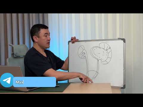 Видео: Гидронефроз хакида. #bola  #rek #urologia #гидронефроз #uzbekistan #doctor #новости