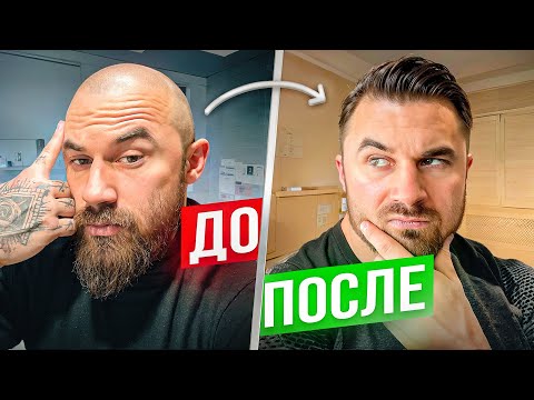 Видео: ПЕРЕСАДКА МЕНЯЕТ ЖИЗНЬ! ДО / ПОСЛЕ