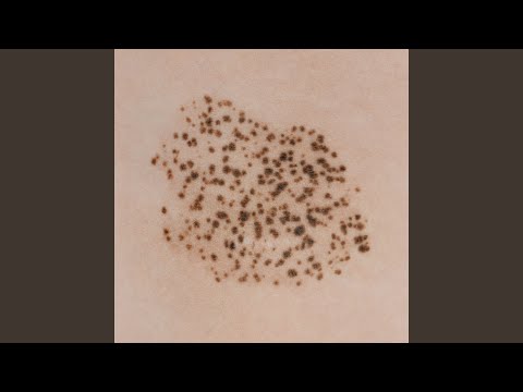 Видео: Аура