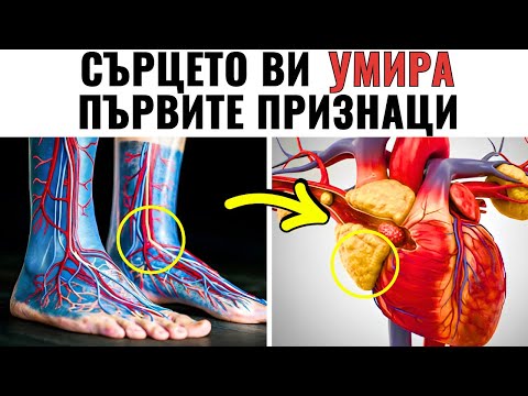 Видео: 7 тихи признака, че артериите ви се запушват точно сега.