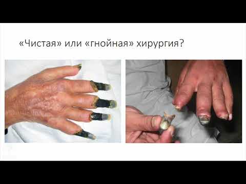 Видео: Организация работы гнойного отделения стационара