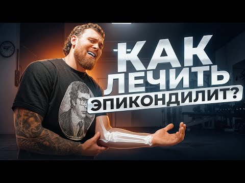 Видео: КАК ВЫЛЕЧИТЬ ЭПИКОНДИЛИТ? ЛОКОТЬ ТЕННИСИСТА ИЛИ ЛОКОТЬ ГОЛЬФИСТА.