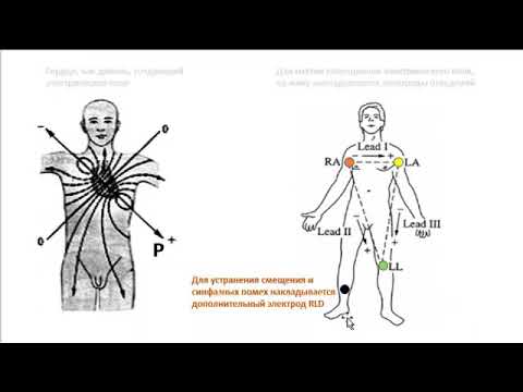 Видео: Схемотехника ЭКГ: ч.1. Источники биопотенциалов и система их снятия