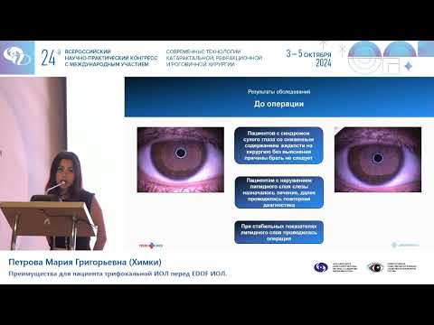 Видео: Преимущества для пациента трифокальной ИОЛ перед EDOF ИОЛ