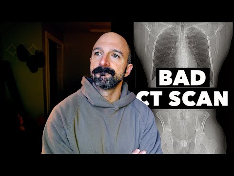 Видео: У МЕНЯ УЖАСНЫЕ НОВОСТИ... (Обновление о раке)