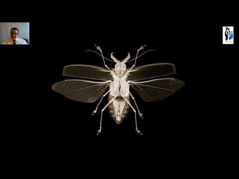 Видео: Лучевая диагностика костно-суставной системы. Лектор А.В. Капишников