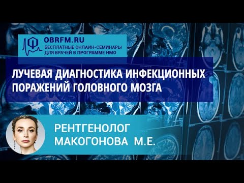 Видео: Рентгенолог Макогонова М.Е.: Лучевая диагностика инфекционных поражений головного мозга