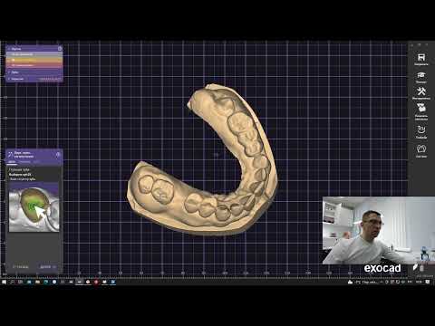 Видео: 2 часть: CAD\CAM. 3D cканирование в Medit,  Exocad модельер и печать временных конструкций.