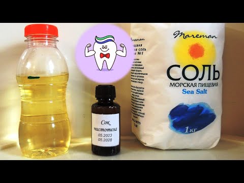 Видео: Зубы - пародонтоз и другие проблемы. Соль 💎 + сок 🍀 чистотела. Простое лечение и профилактика.