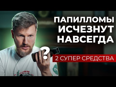 Видео: Как избавиться от папиллом и бородавок навсегда? 2 средства для идеальной кожи