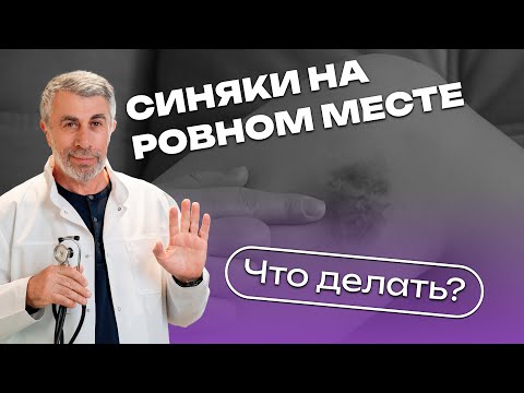 Видео: Синяки на ровном месте. Что делать?