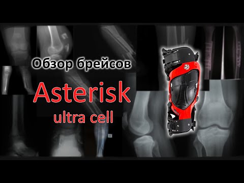 Видео: Обзор Asterisk ultra cell. Разговор о наколенниках.