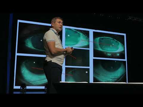 Видео: Клиническая значимость стратегического подхода к выбору контактной коррекции зрения