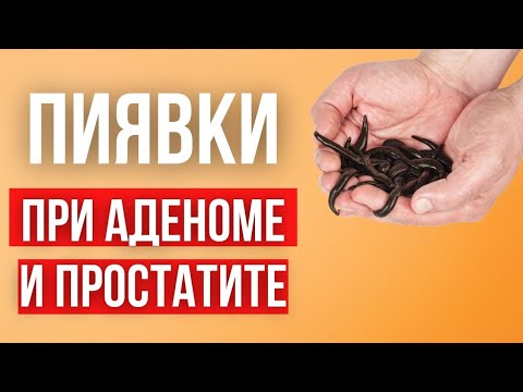 Видео: Пиявки при простатите и аденоме.