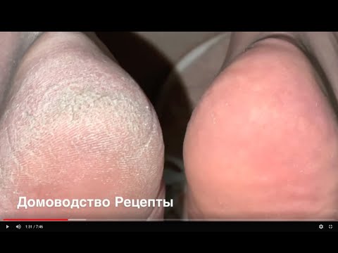 Видео: ДЛЯ ГЛАДКИХ ПЯТОК НУЖЕН ЭТОТ СПРЕЙ
