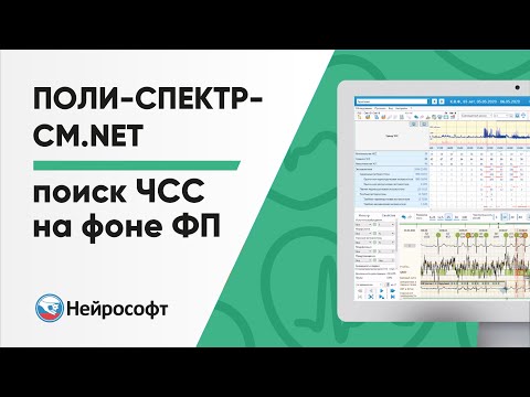 Видео: Поиск максимальной и минимальной ЧСС на фоне ФП в программе Поли-Спектр-СМ.NET