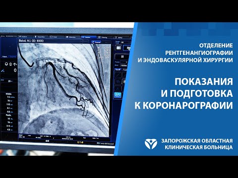 Видео: Коронарография. Показания, риски, подготовка и рекомендации после процедуры.