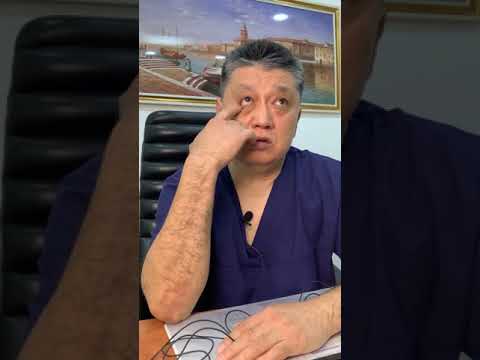 Видео: МИОМА МАТКИ: наблюдать, лечить или оперировать❓🤷🏻‍♀️