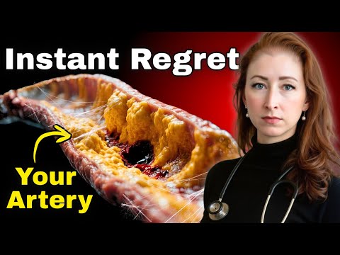 Видео: Три вещи, которых я избегаю как сосудистый хирург (они быстро закупоривают артерии!)