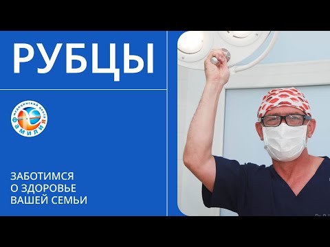 Видео: 👉​ Рубцы