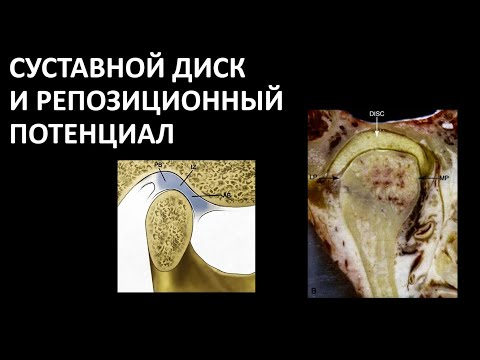 Видео: ДИСФУНКЦИЯ ВНЧС РЕПОЗИЦИОННЫЙ ПОТЕНЦИАЛ