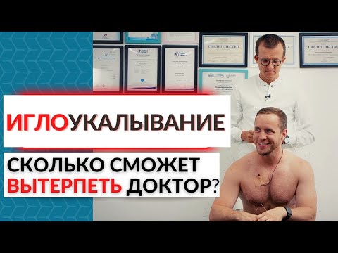 Видео: Выпуск про иглоукалывание / Ткачев, 150 ИГЛ и Епифанов.