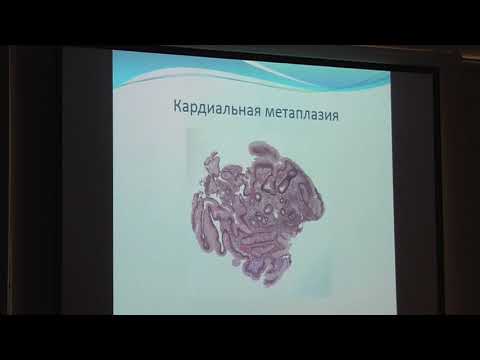 Видео: 55 Михалева ЛМ Патоморфология пищевода Барретта