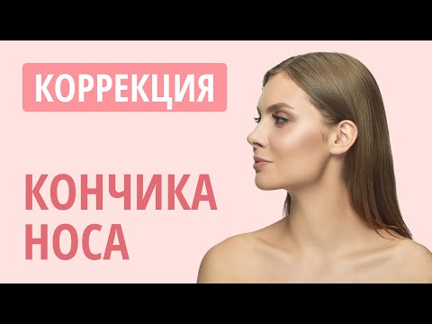 Видео: 👃 Пластика кончика носа