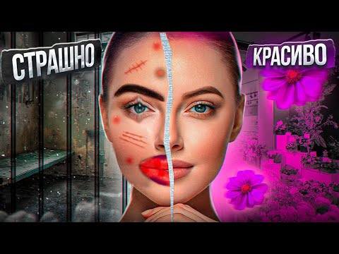 Видео: Опасная косметология.  Штраф 250.000 рублей за смерть пациентки