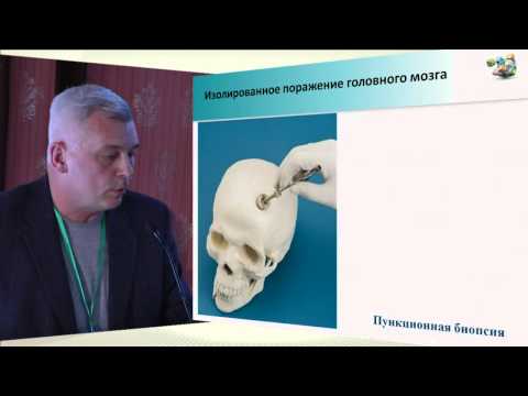 Видео: И.Г. Комаров. ""Опухоли без выявленного первичного очага"
