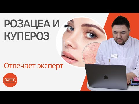 Видео: Розацеа и купероз: отвечает эксперт